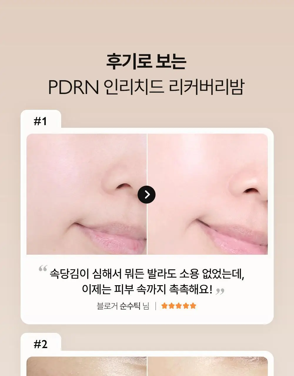 제나벨 PDRN 인리치드 리커버리 밤 50ml 상세페이지 4