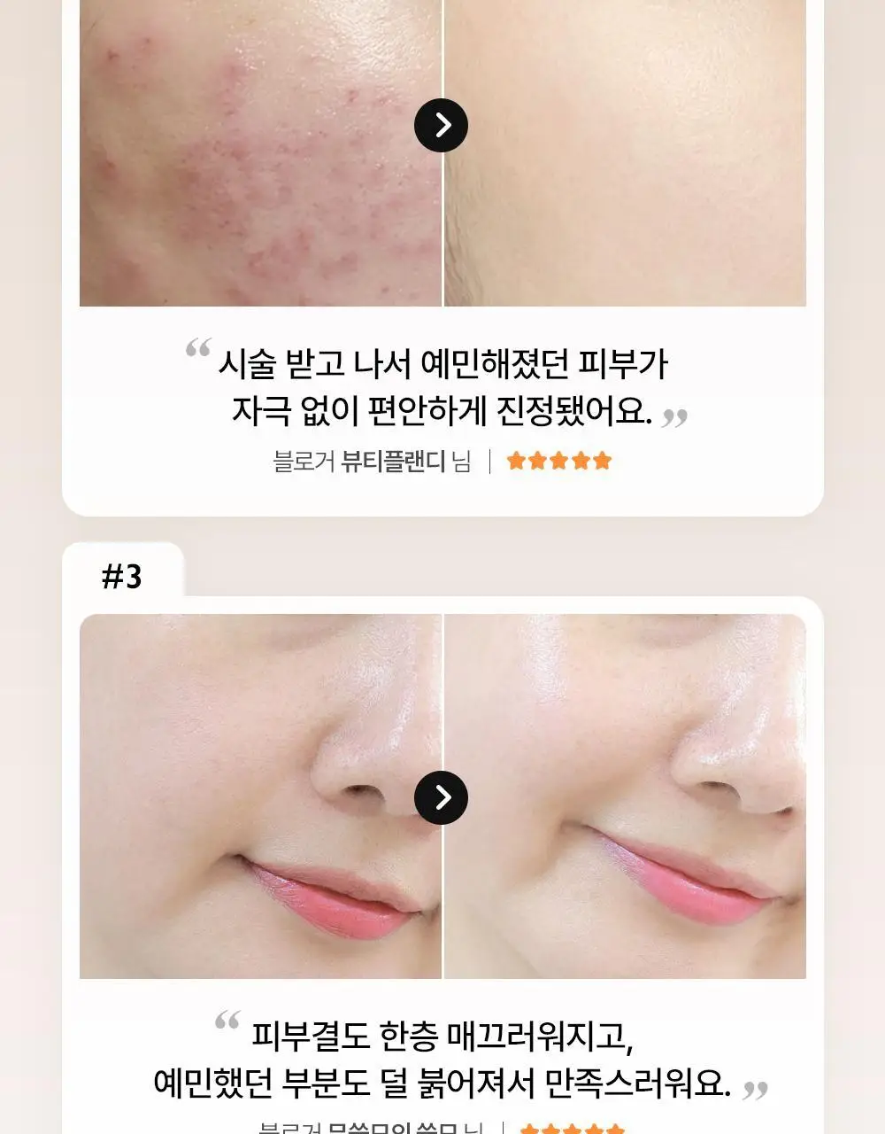 제나벨 PDRN 인리치드 리커버리 밤 50ml 상세페이지 5