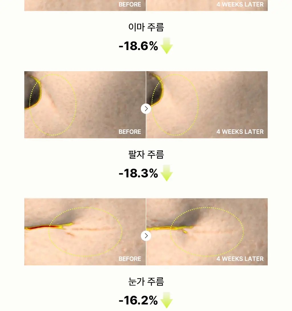 코스알엑스 더 레티놀 0.1 크림 20ml 상세페이지 9
