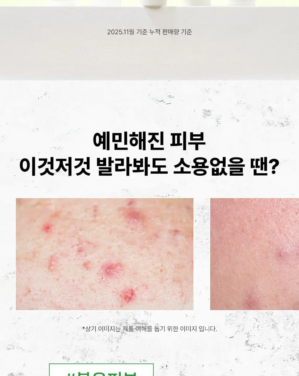 파파레서피 마데케어 연고 33g 상세페이지 2