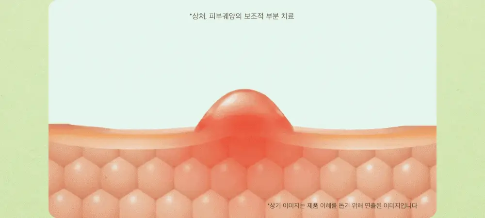 파파레서피 마데케어 연고 33g 상세페이지 10