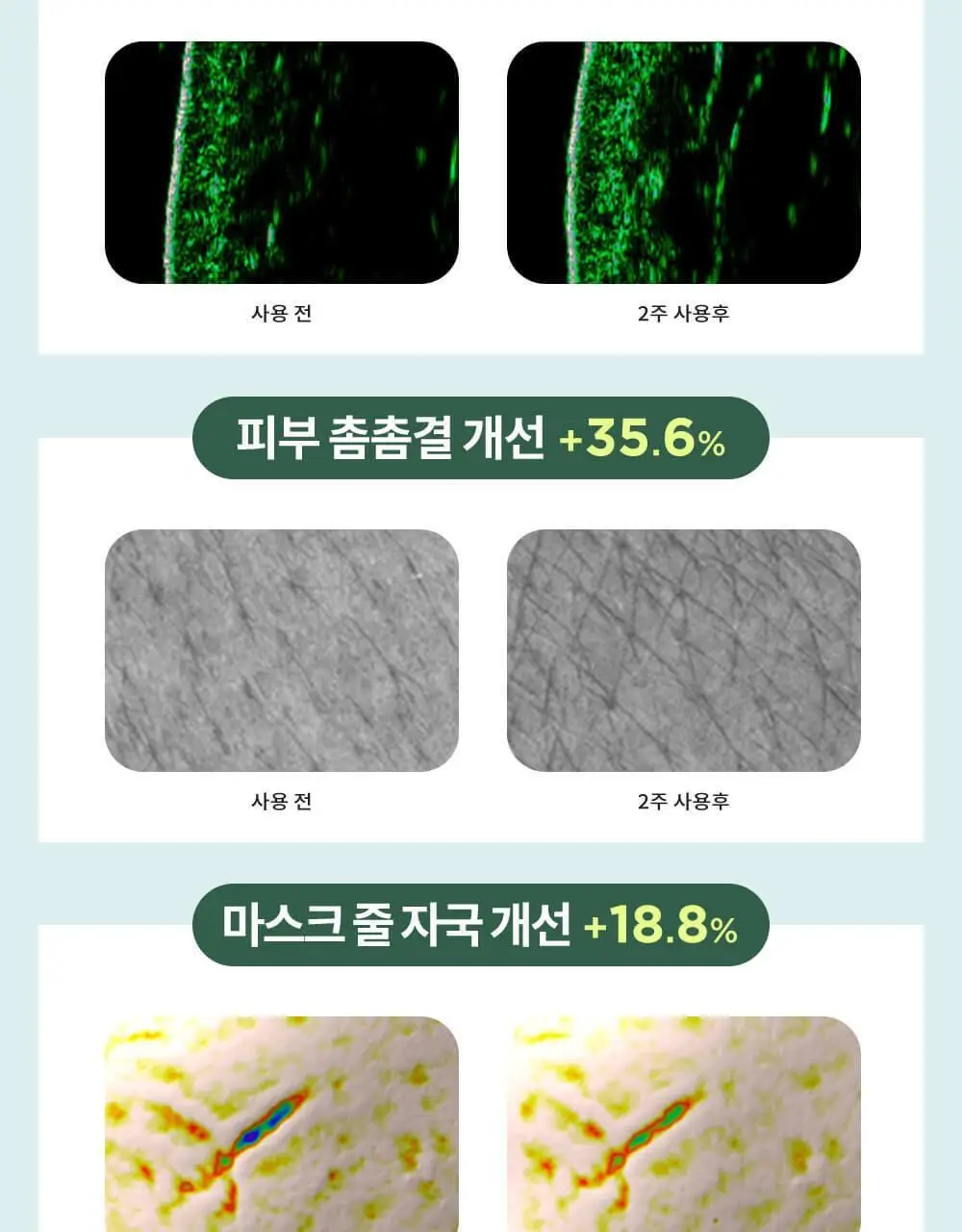 CKD 레티노콜라겐 저분자 300 크림 1+1 기획 상세페이지 12