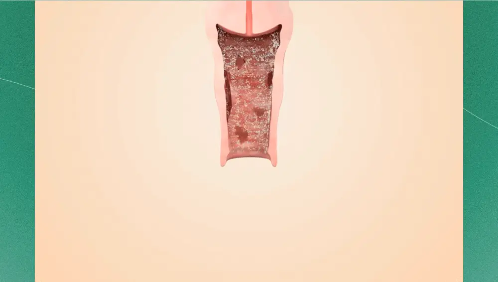 미스미즈 이너 리프레싱 워시 50ml 3개입 상세페이지 4