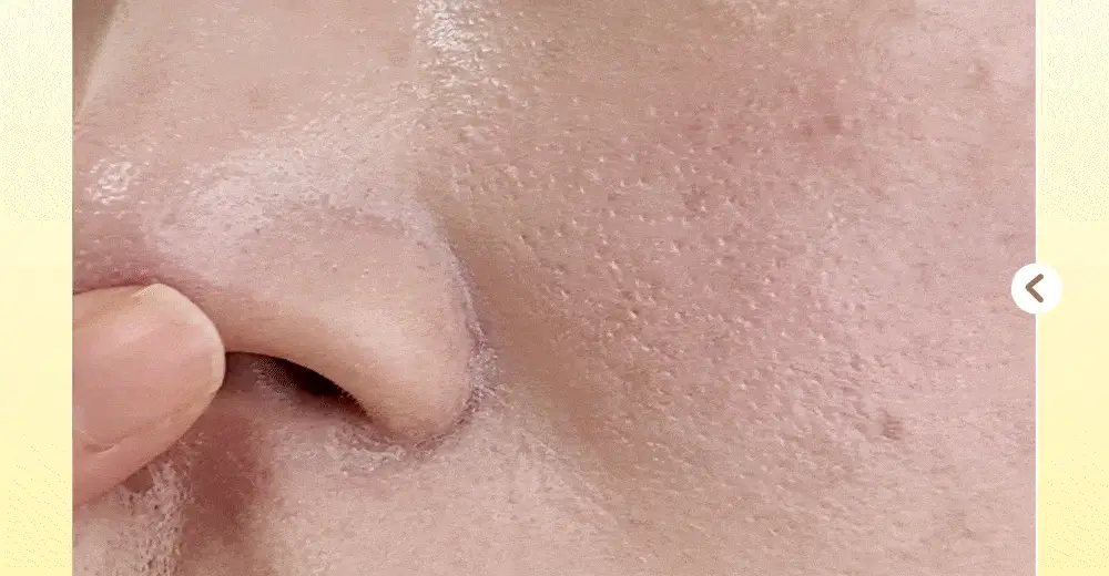 아이레시피x리틀트윈스타 세라마이드 유자 힐링 클렌징밤 135ml 기획 (+10ml+헤어핀) 상세페이지 5