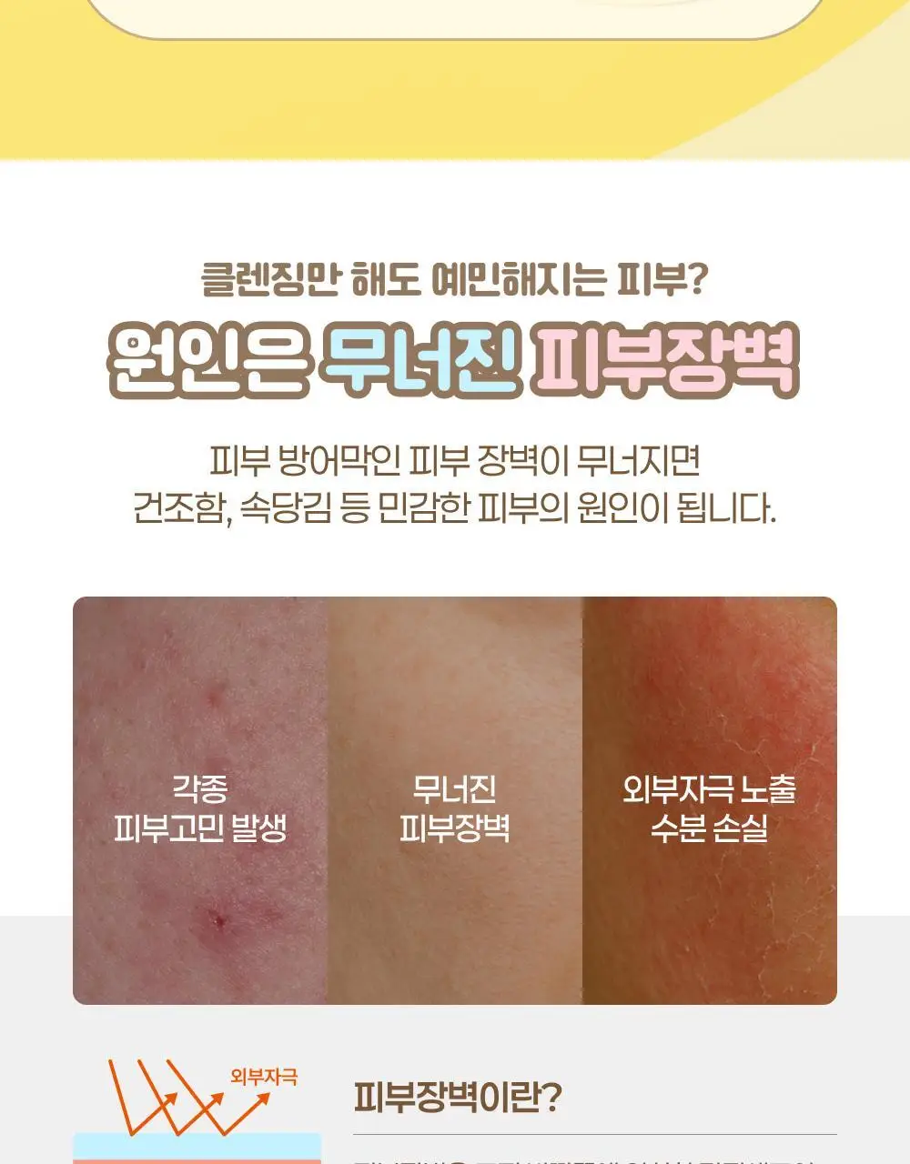 아이레시피x리틀트윈스타 세라마이드 유자 힐링 클렌징밤 135ml 기획 (+10ml+헤어핀) 상세페이지 22