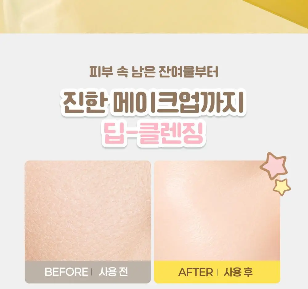 아이레시피x리틀트윈스타 세라마이드 유자 힐링 클렌징밤 135ml 기획 (+10ml+헤어핀) 상세페이지 35