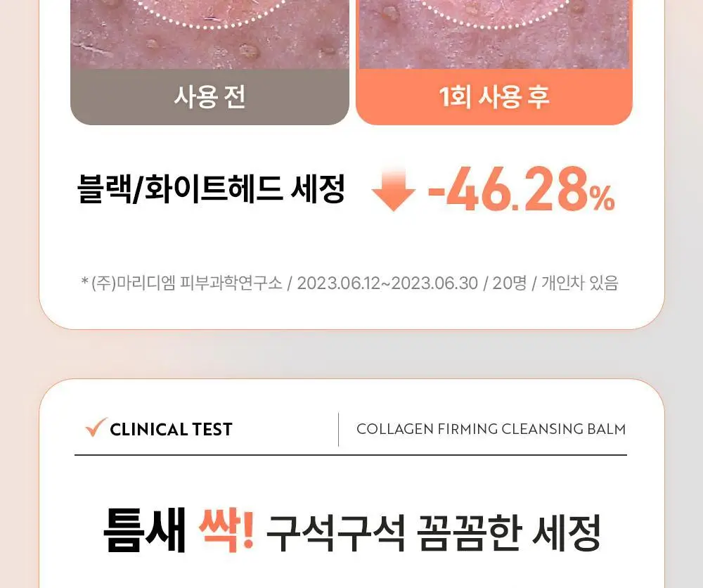 유이크 바이옴 베리어 콜라겐 퍼밍 클렌징밤 100ml 상세페이지 23