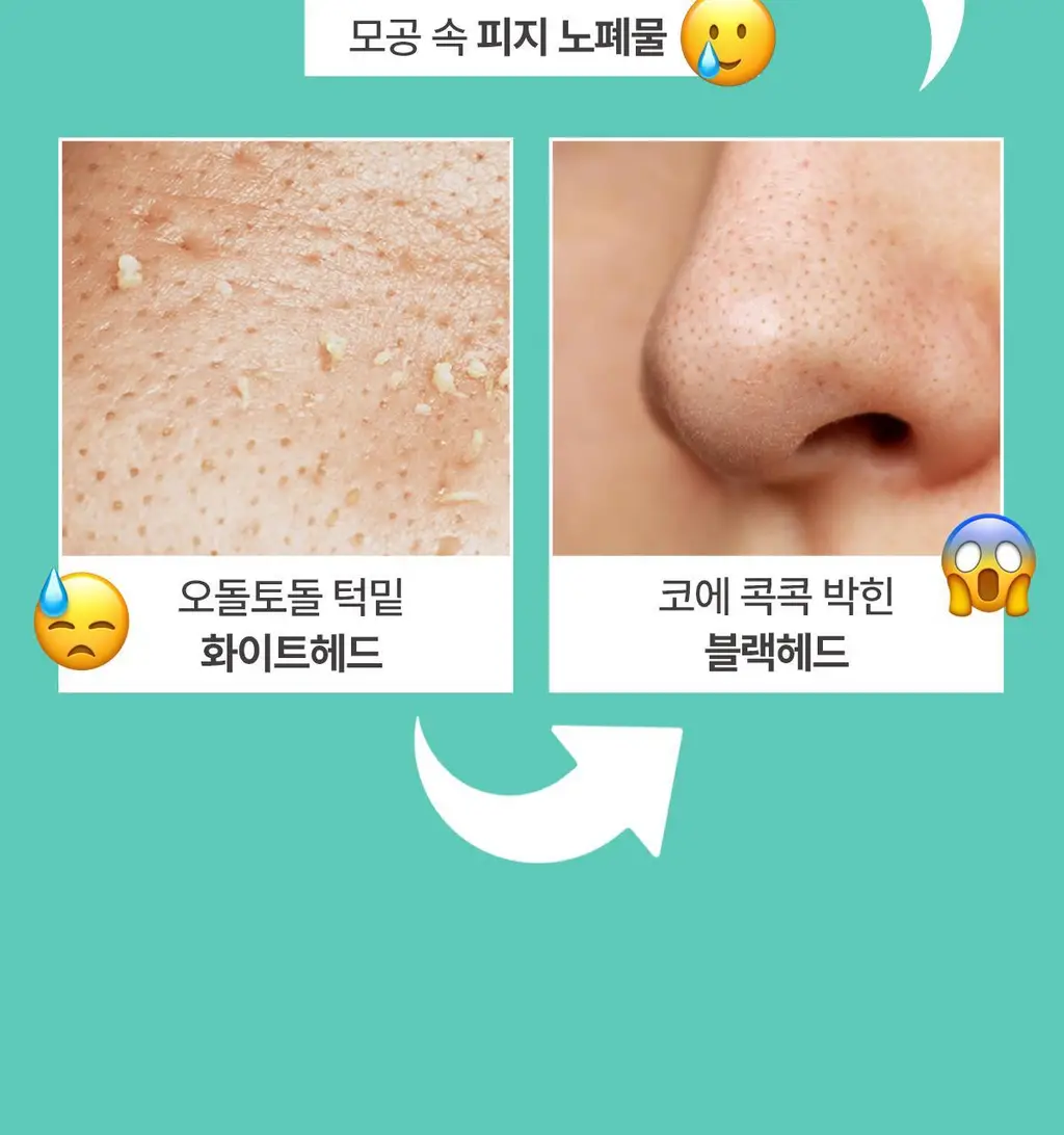 포인트앤 딥멜팅 소이 클렌징 밤 90ml 상세페이지 3