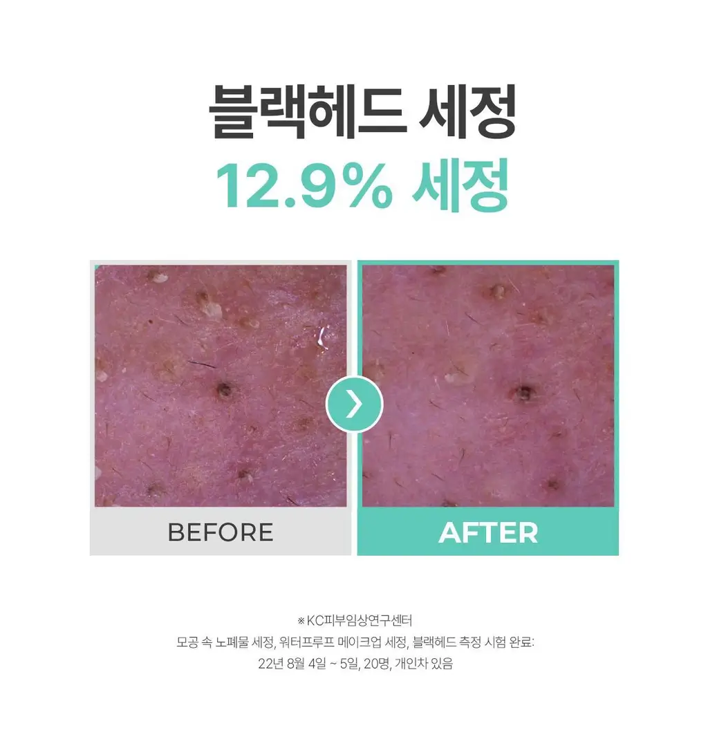 포인트앤 딥멜팅 소이 클렌징 밤 90ml 상세페이지 15