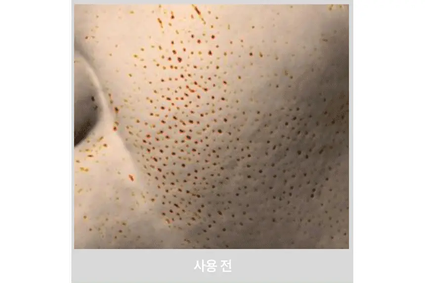 딘시 프리미엄 비건 눈연꽃 히알루론산 수분 클렌징오일 200ml 상세페이지 11