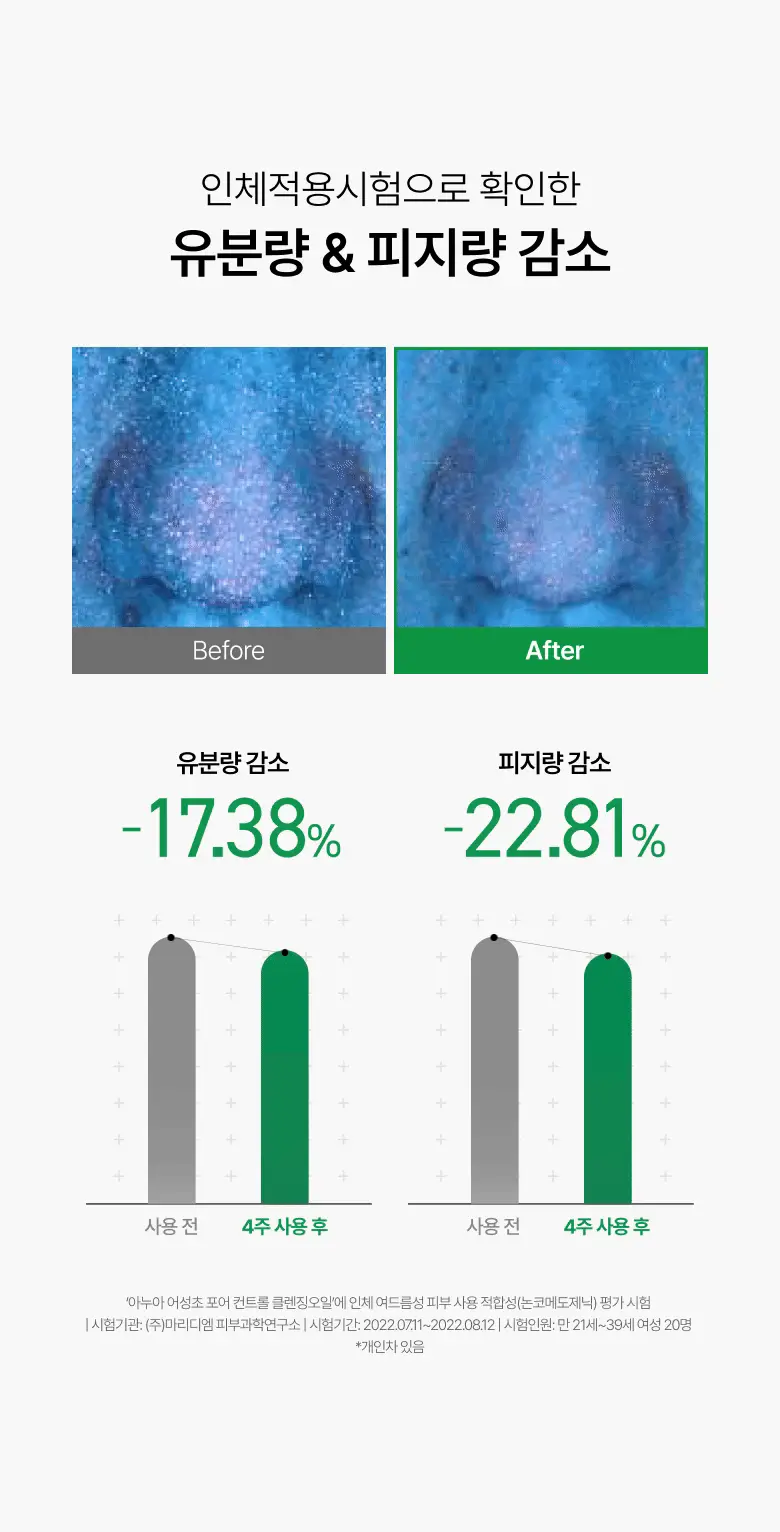 아누아 어성초 포어 컨트롤 클렌징오일 200ml 2입 상세페이지 5