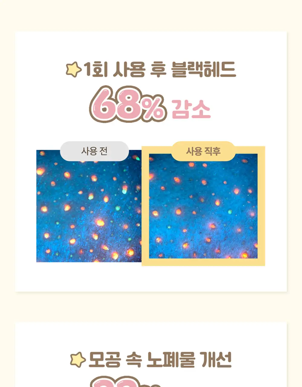 아이레시피x리틀트윈스타 세라마이드 유자 바이오 클렌징오일 200ml 기획 상세페이지 39