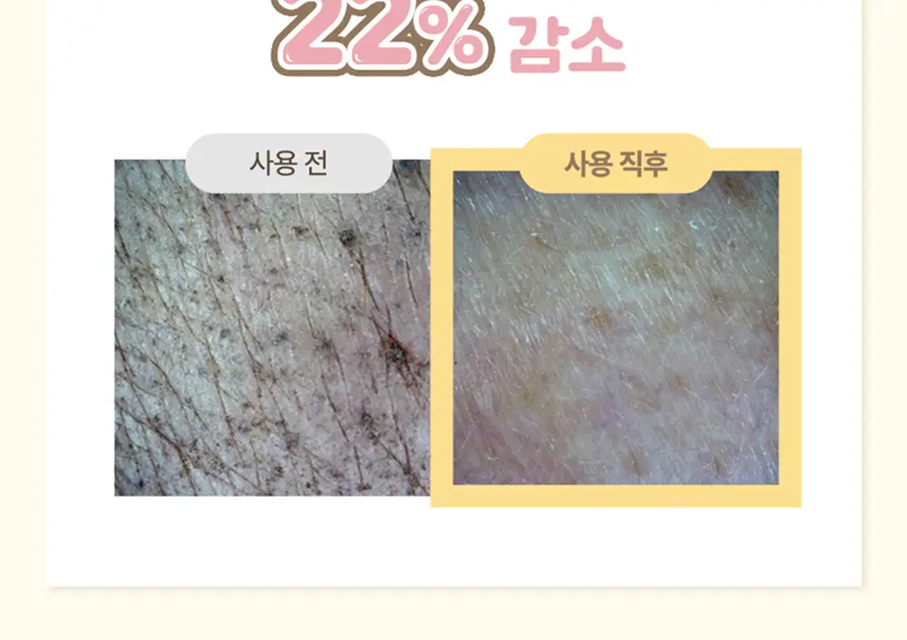 아이레시피x리틀트윈스타 세라마이드 유자 바이오 클렌징오일 200ml 기획 상세페이지 40