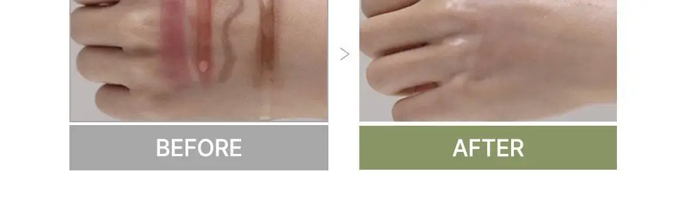 에센허브 소이빈90 딥클렌징오일 유칼립투스 300ml 상세페이지 10
