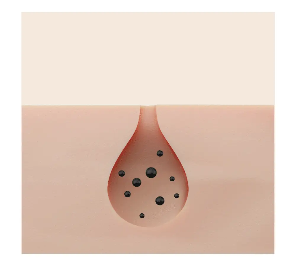 유리피부 그란떼 클렌징 오일 (본품 300ml+30ml 추가 증정) 상세페이지 17