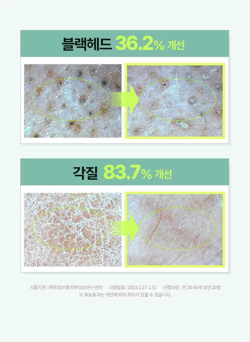 일소 네추럴 마일드 클렌징 오일 200ml 기획(+30ml 증정) 상세페이지 9