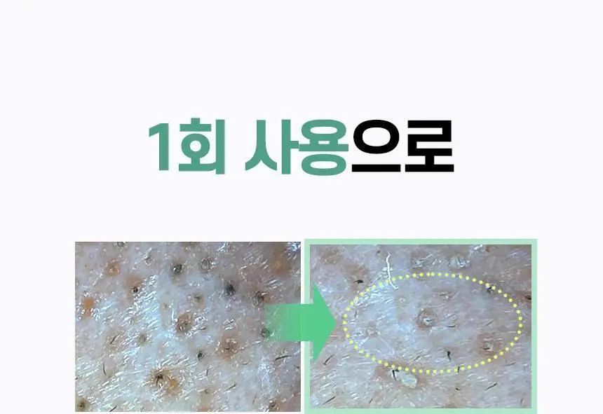 일소 네추럴 마일드 클렌징 오일 200ml 기획(+30ml 증정) 상세페이지 25