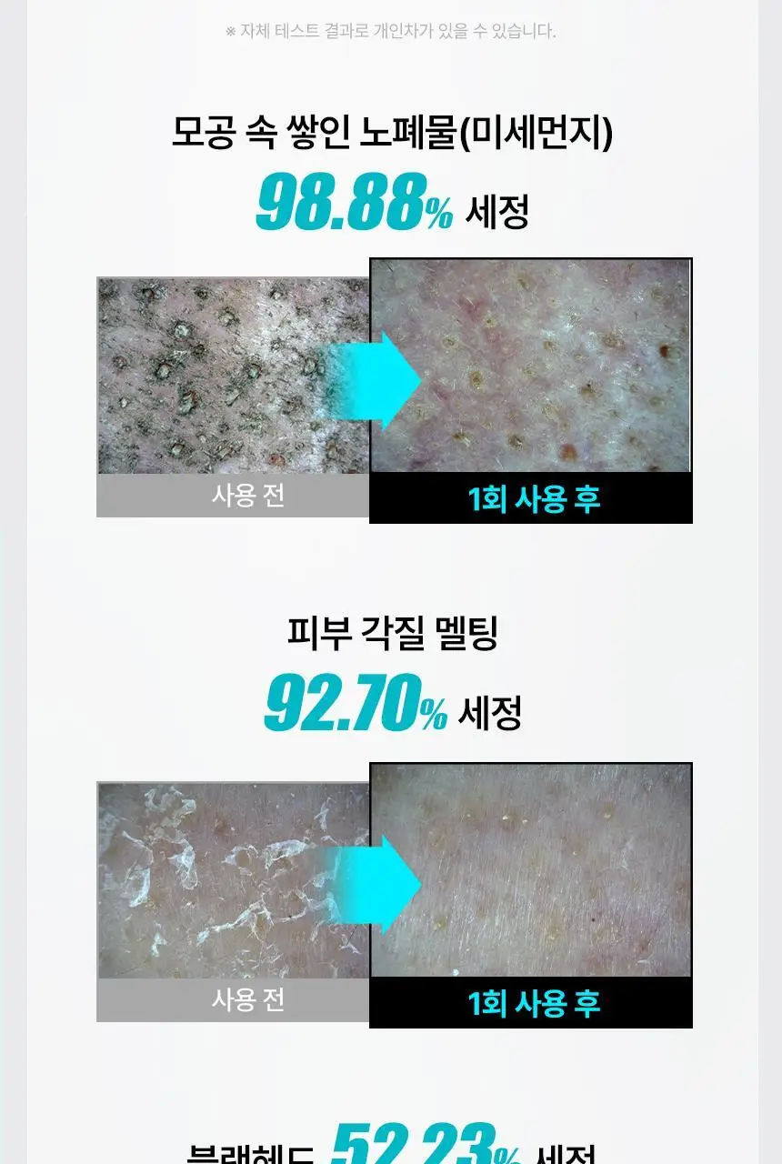 일소 슈퍼 멜팅 세범 클렌징오일 200ml 기획 (+듀얼클린브러쉬) 상세페이지 13