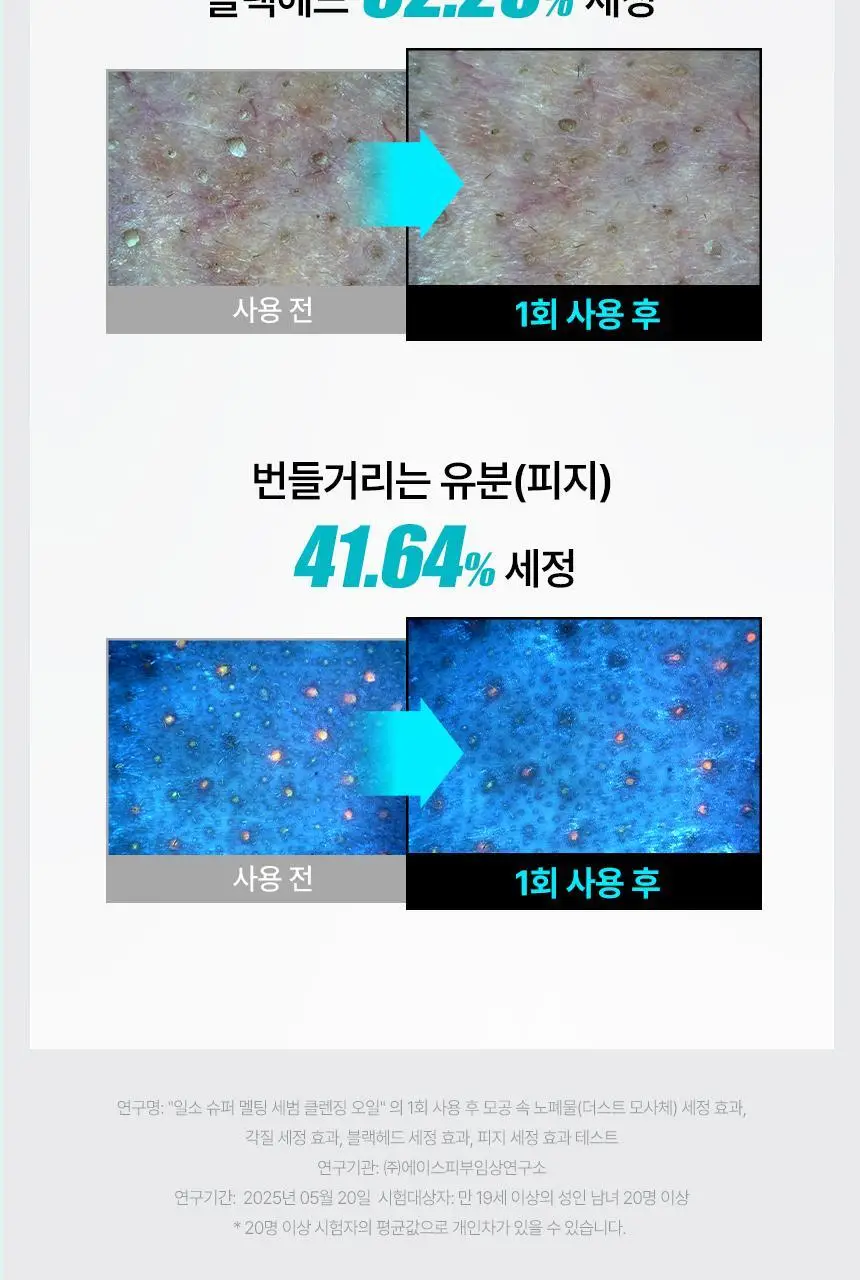 일소 슈퍼 멜팅 세범 클렌징오일 200ml 기획 (+듀얼클린브러쉬) 상세페이지 14