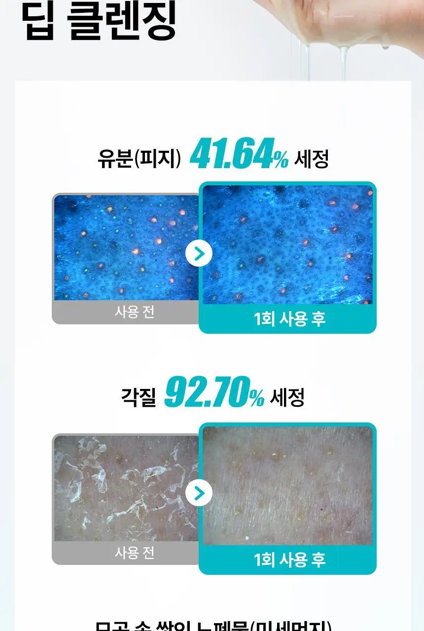 일소 슈퍼 멜팅 세범 클렌징오일 200ml 기획 (+리필 200ml) (2603) 상세페이지 15