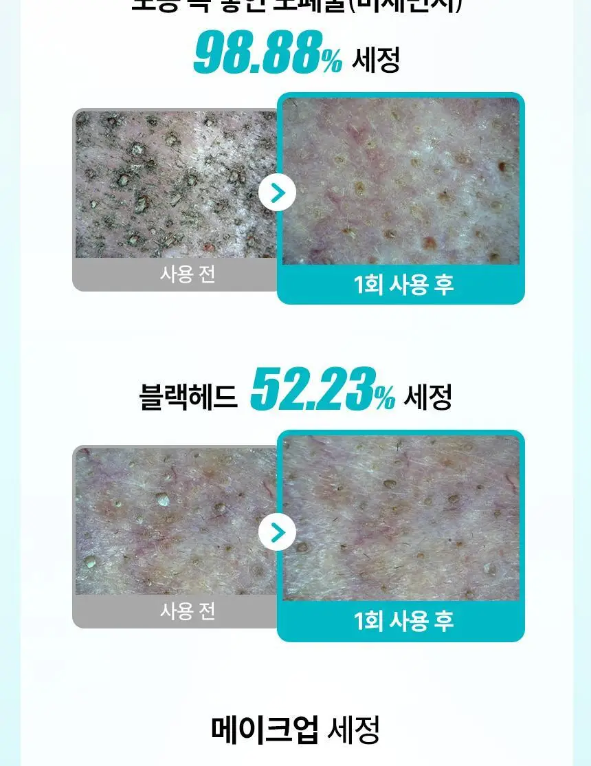 일소 슈퍼 멜팅 세범 클렌징오일 200ml 기획 (+리필 200ml) (2603) 상세페이지 16