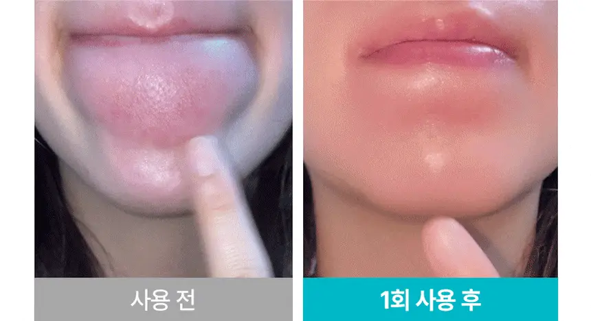 일소 슈퍼 멜팅 세범 클렌징오일 200ml 기획 (+리필 200ml) (2603) 상세페이지 23