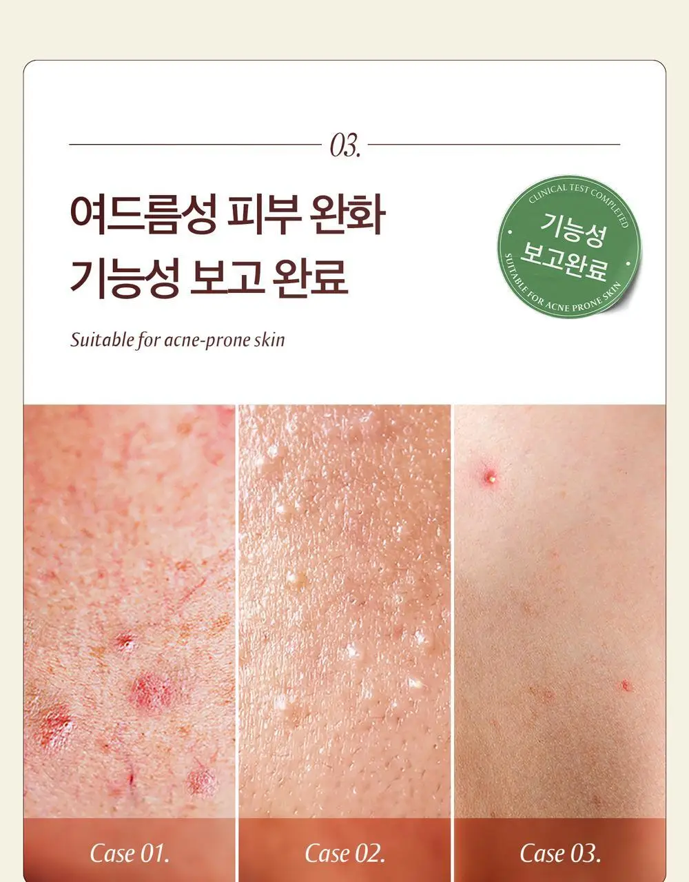 블랑네이처 9배 어성초 버블 클렌징 밀크 150ml 기획 (+30ml) 상세페이지 20