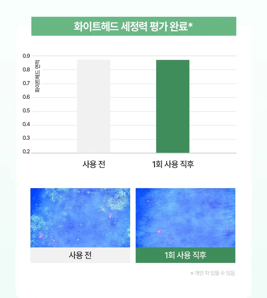 듀댑 요거트팩 클렌저 150ml+15ml 3종 (시카티/듀톡스/레몬 커스터드) 상세페이지 41