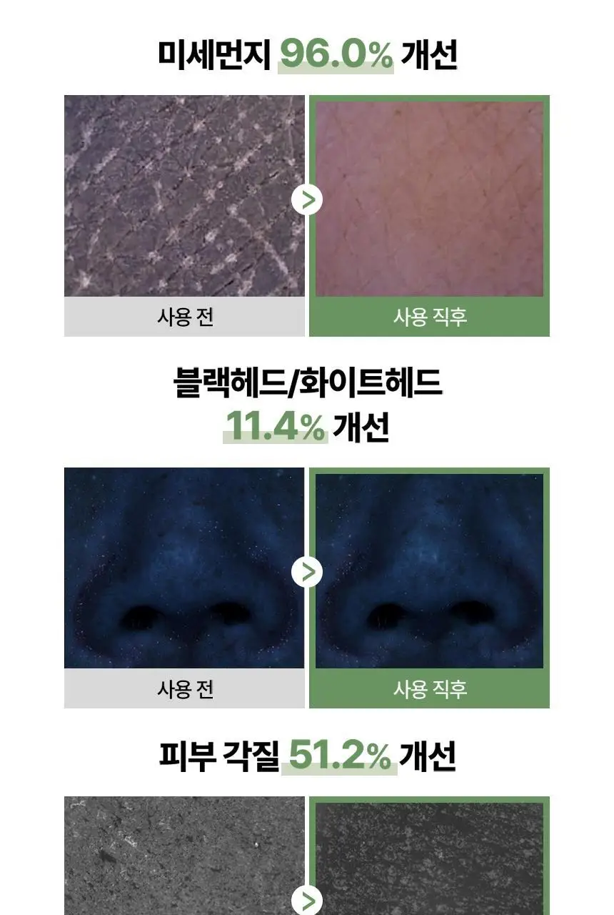딘시 프리미엄 비건 약산성 히알루론산 폼클렌저 150ml 상세페이지 13