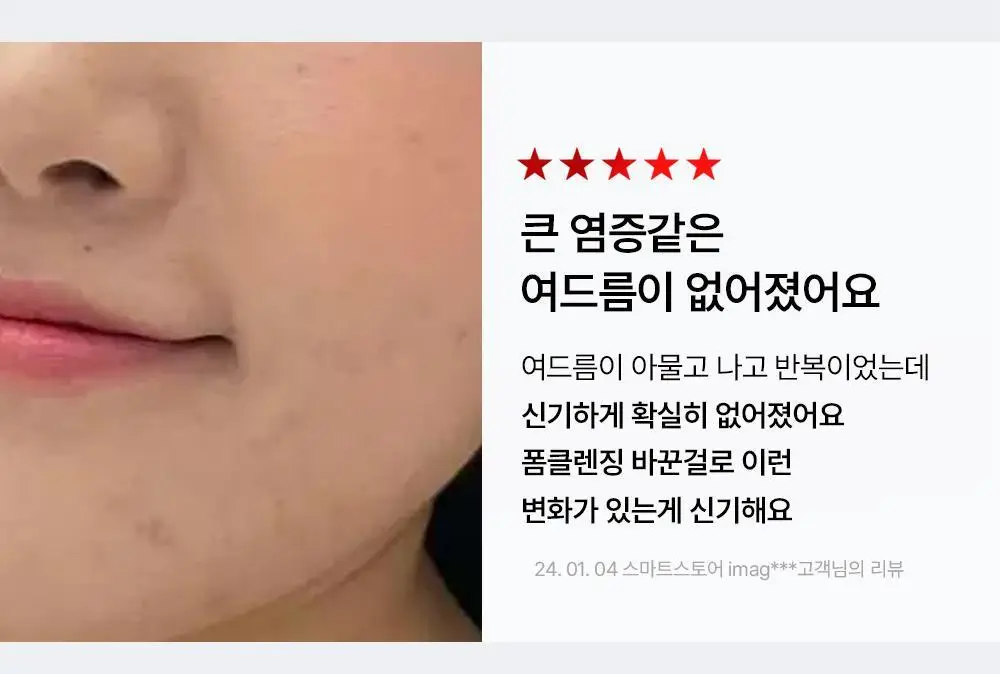 벨프리모 안티크네 약산성 젤클렌저 125g 기획 (+30g) 상세페이지 22