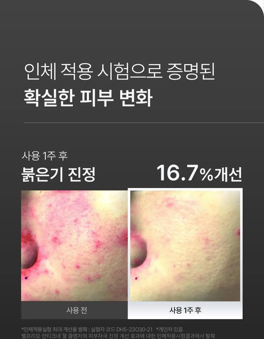 벨프리모 안티크네 약산성 젤클렌저 125g 기획 (+30g) 상세페이지 26