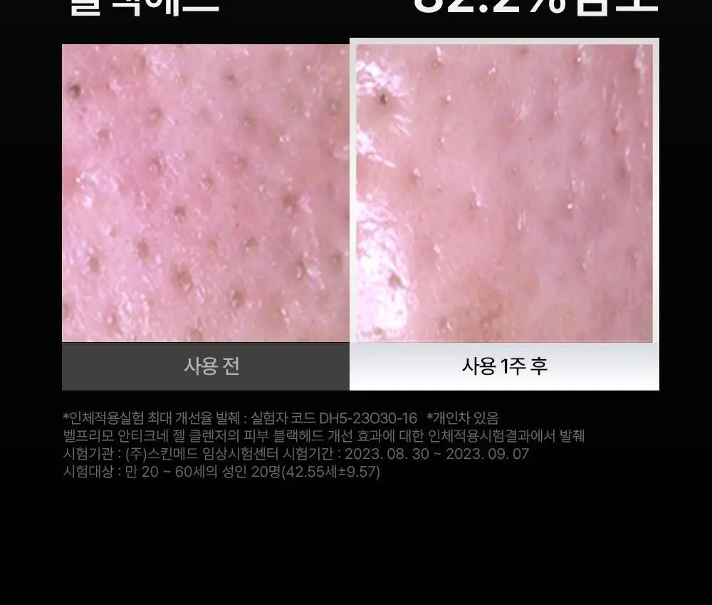 벨프리모 안티크네 약산성 젤클렌저 125g 기획 (+30g) 상세페이지 28