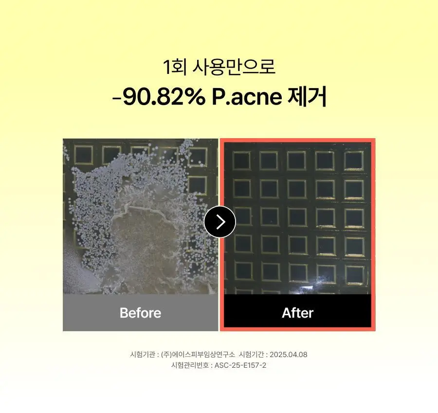 셀라딕스 트러블 클리어 약산성 젤클렌저 200ml 상세페이지 8