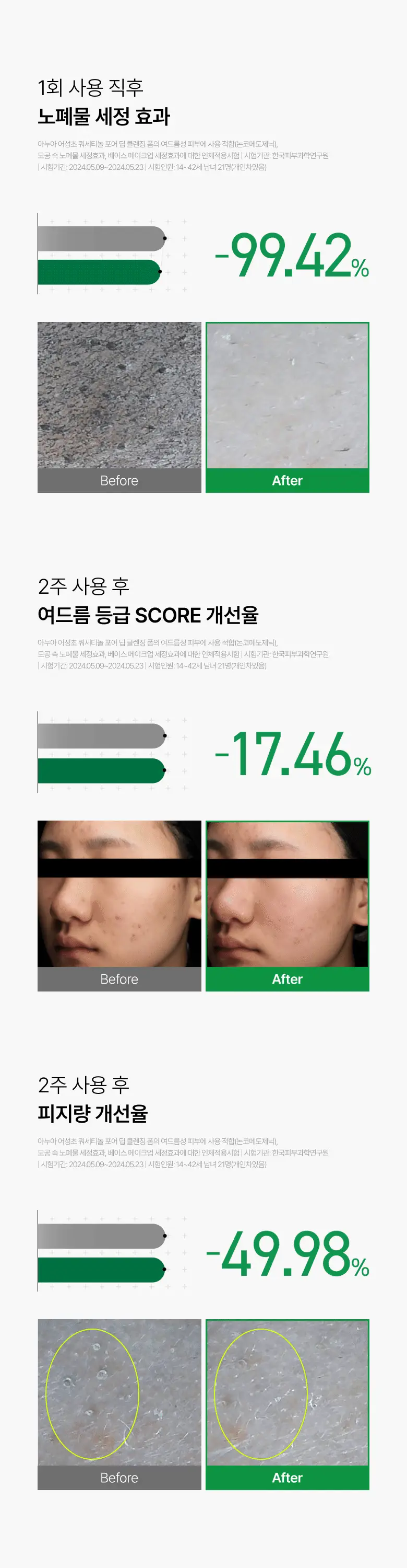 아누아 어성초 피지쏙 모공 폼 150ml 2입 기획 상세페이지 8