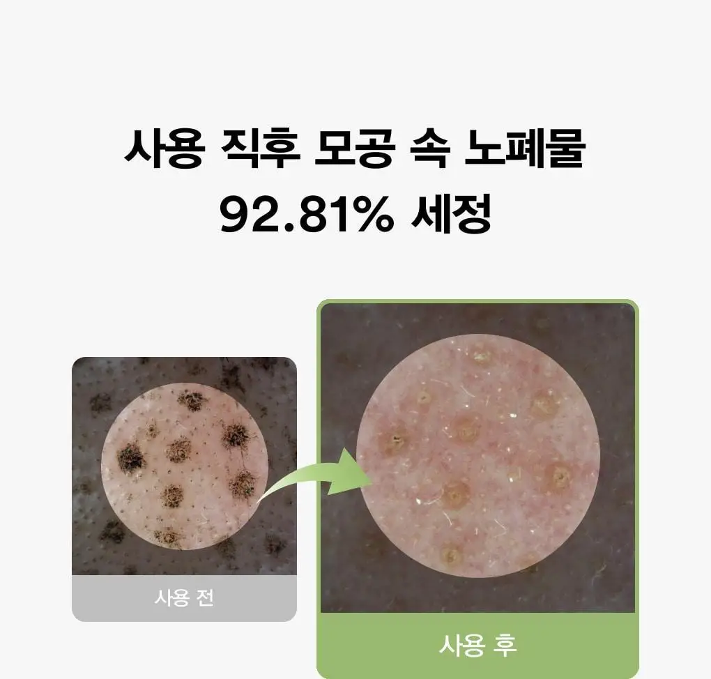 아비브 포어 클레이 팩 클렌저 어성초 차콜 팩 투 폼 120ml 기획 (+30ml) 상세페이지 14