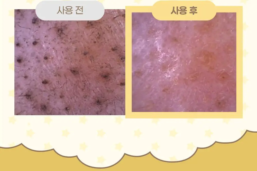 아이레시피x리틀트윈스타 세라마이드 유자 약산성 클렌징폼 150ml 더블 기획 (+스티커) 상세페이지 28