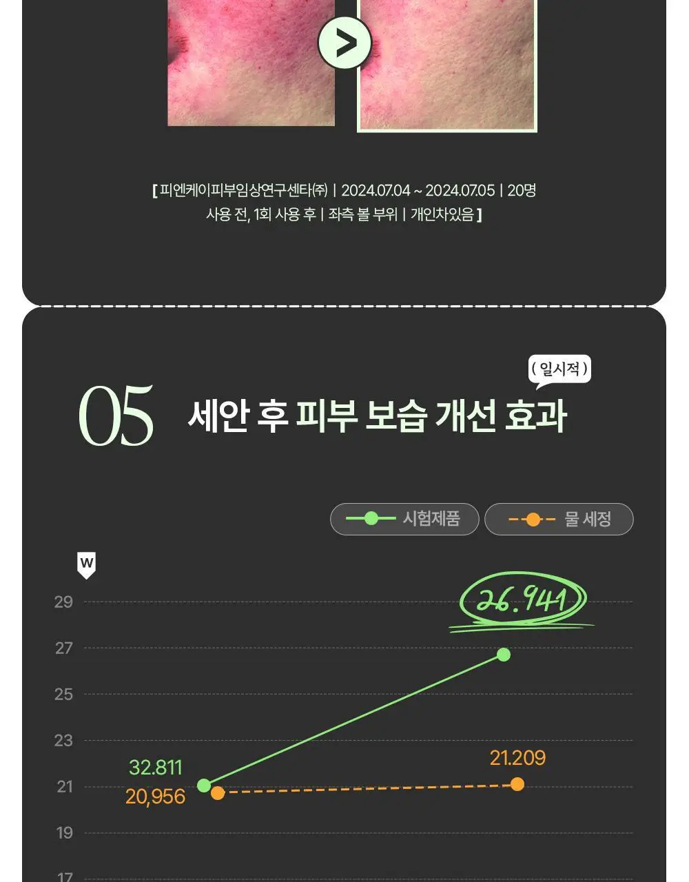 에센허브 티트리 릴리프 폼클렌저 150ml 상세페이지 20