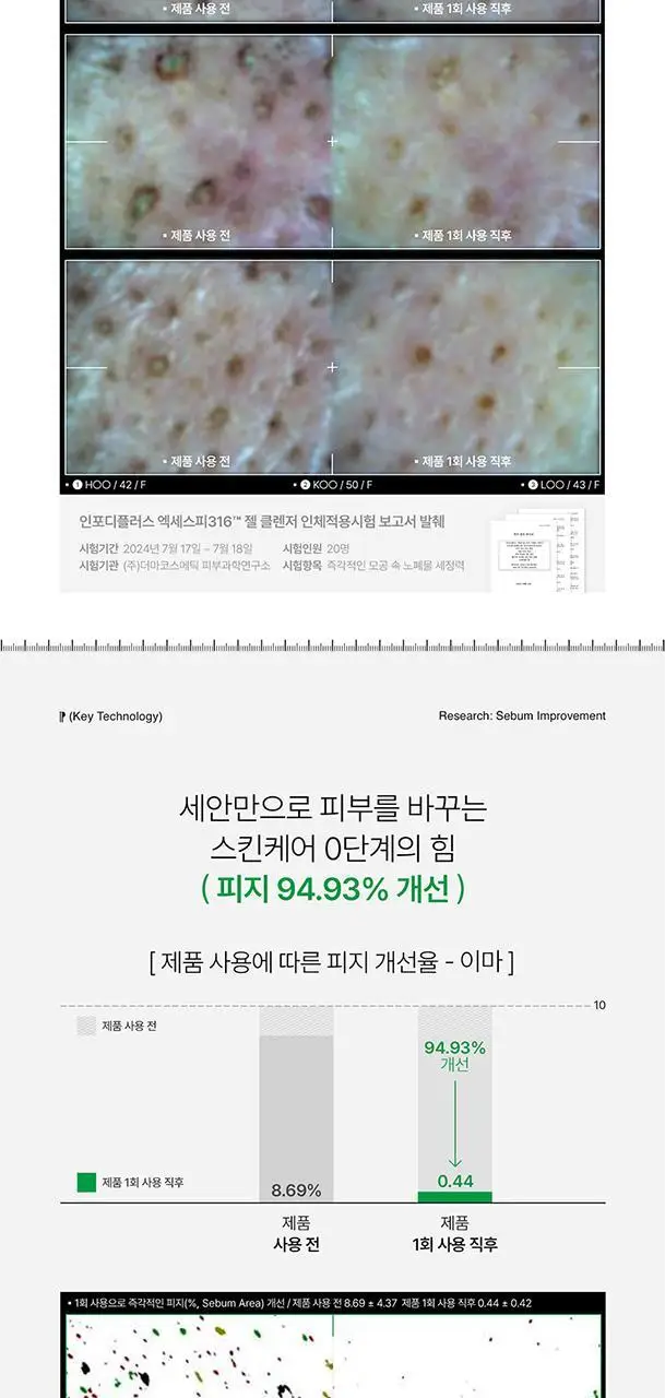 인포디플러스 엑세스피316 젤 클렌저 125ml 상세페이지 5