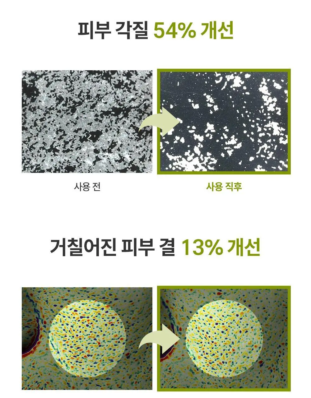 제로이드 인텐시브 페이셜 크림 클렌저 180ml 상세페이지 15