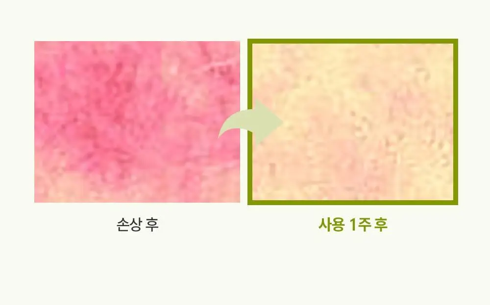 제로이드 인텐시브 페이셜 크림 클렌저 180ml 상세페이지 19