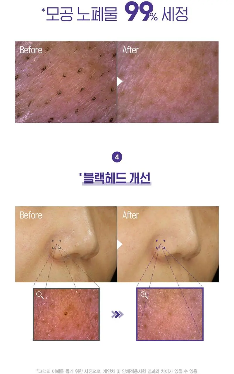 해피바스 마이크로 클린 버블 클렌징폼 300ML(솝베리/딥) 상세페이지 9