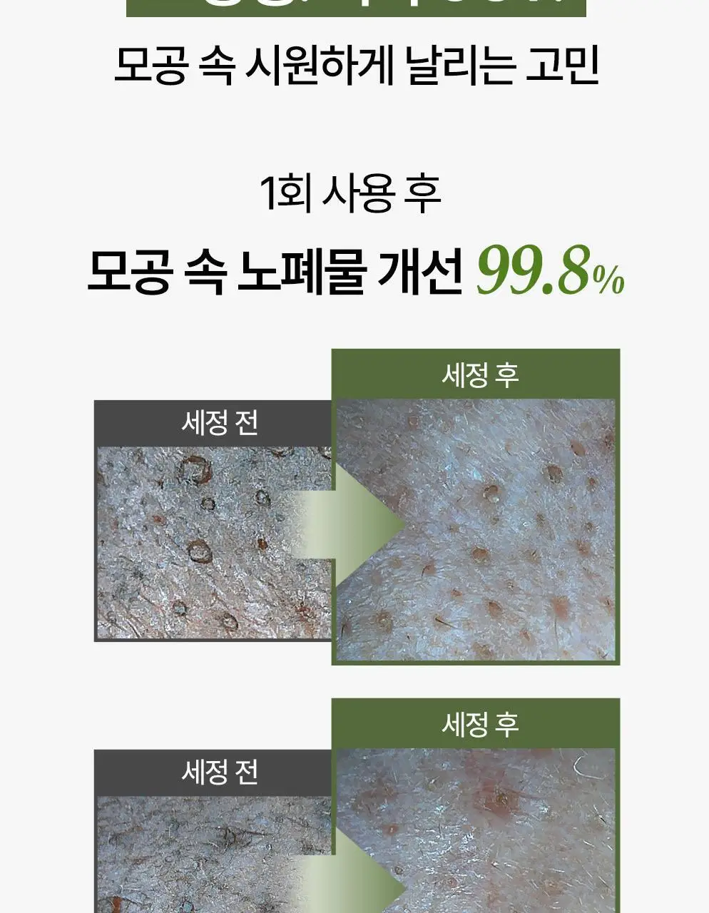 CKD 그린플럼 아하바하 피지제로 팩솝 클렌저 130g (+모공브러시 증정) 상세페이지 11