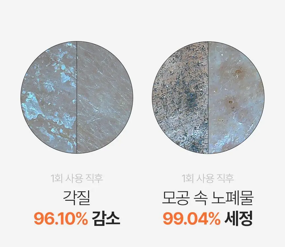 파파레서피 효소 파우더 클렌저 파우치(1.2g*12개입)_블레미쉬/가지/티트리 상세페이지 14