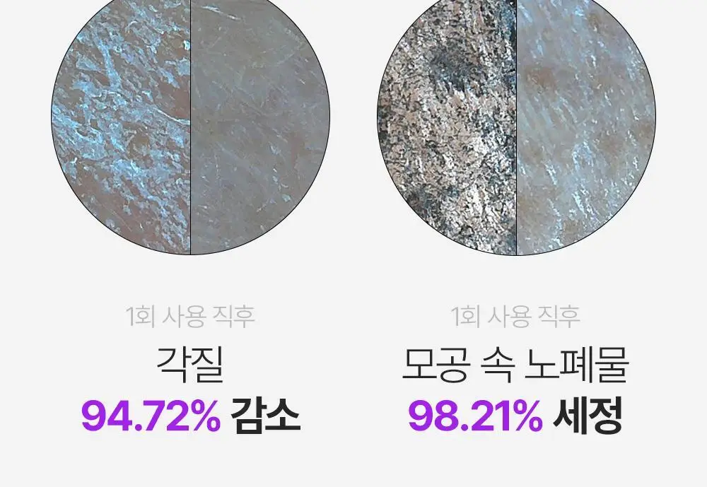 파파레서피 효소 파우더 클렌저 파우치(1.2g*12개입)_블레미쉬/가지/티트리 상세페이지 18