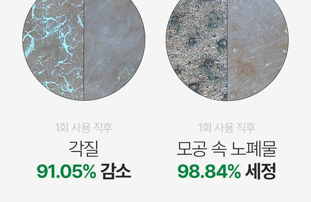 파파레서피 효소 파우더 클렌저 파우치(1.2g*12개입)_블레미쉬/가지/티트리 상세페이지 24