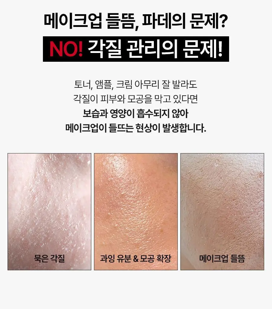 메디필 레드 락토 콜라겐 곤약 필링젤 95ml 기획 (+레드락토폼 15ml) 상세페이지 4
