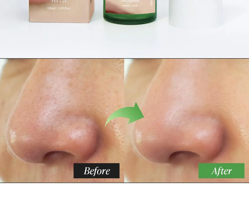 닥터엘시아 프리미엄 퀵 스텝 세범 클렌저 100ml 상세페이지 10