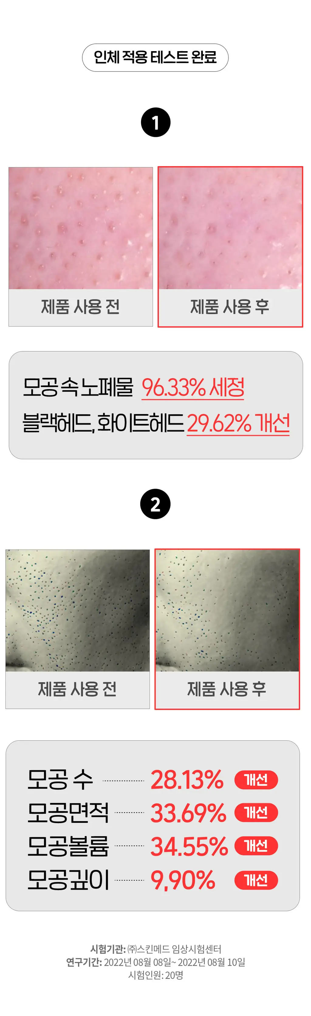 닥터원더 원더 블랙헤드 석션워터 150ml 상세페이지 4