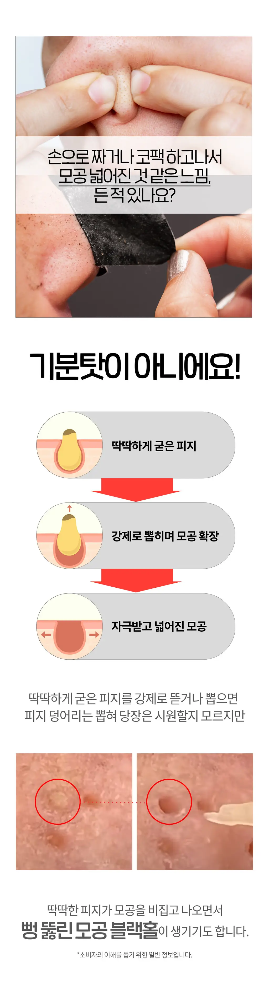 닥터원더 원더 블랙헤드 석션워터 150ml 상세페이지 7