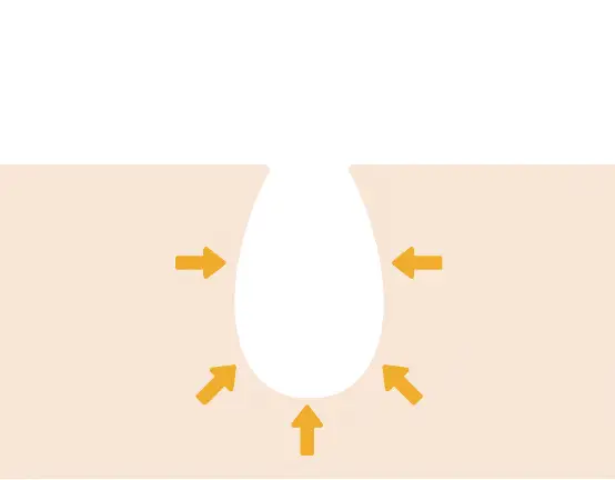 닥터원더 원더 블랙헤드 석션워터 150ml 상세페이지 25